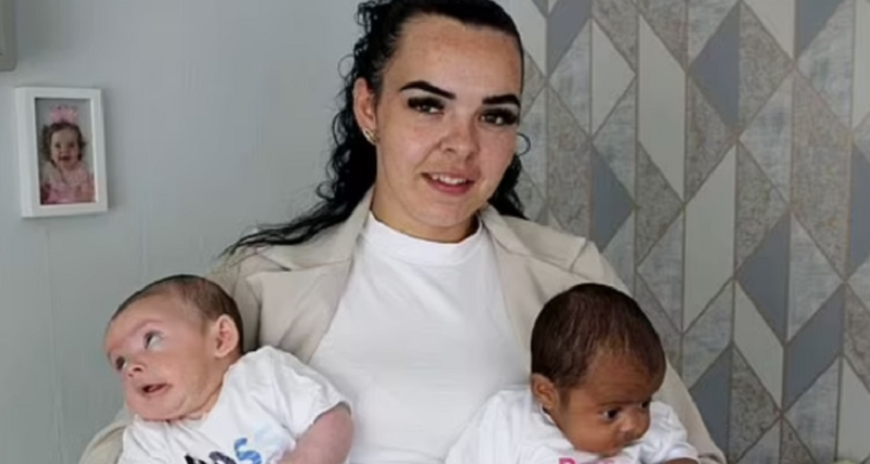 Çuditet nëna që lindi binjakë, njërin të bardhë dhe tjetrin me ngjyrë